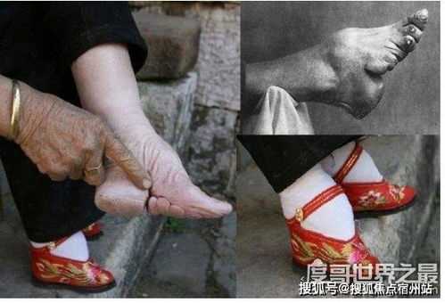 裹脚是从什么时候开始的(裹脚一般从几岁开始)