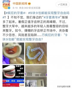 ​整形牙齿 整牙堪比整容？真的！但前提是满足这些条件