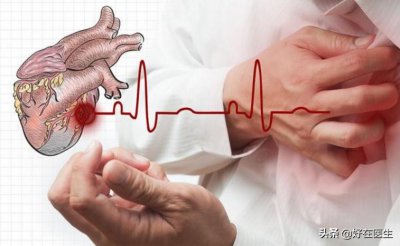 ​什么是冠心病 冠心病的早期症状有哪些（什么是冠心病？冠心病的早期症状有哪些