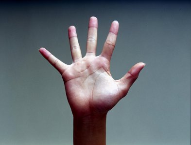 ​手指头脱皮是什么原因（手上总是脱皮怎么办？可能不只是“干”出来的，4个原