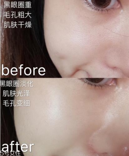 兰蔻小黑瓶面膜怎么用 兰蔻小黑瓶面膜要洗吗