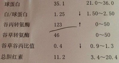 ​谷草转氨酶是什么?从其正常值|作用|偏高|偏低深入介绍