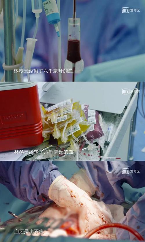 “孕28 周，孩子活了，我死了！” 我曾经以为怀孕很容易，我错了