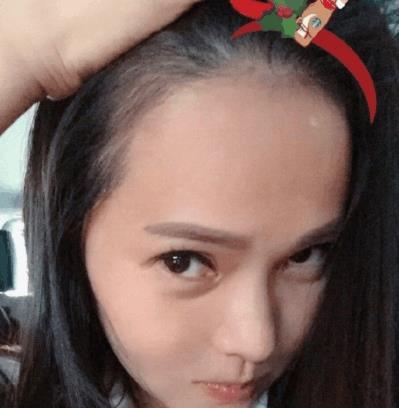你不懂女星的哀伤! 杨幂扬言要植发